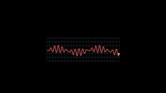 Torsades de Pointes ECG Rhythm Animation Clean No Text Heart Monitor Alpha 4K