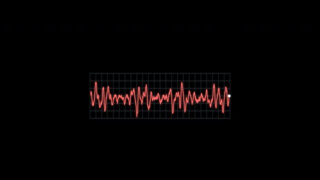 Ventricular Fibrillation ECG Rhythm Animation Clean No Text Alpha 4K