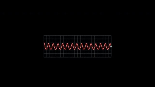 Ventricular Tachycardia ECG Rhythm Animation Clean No Text Alpha 4K