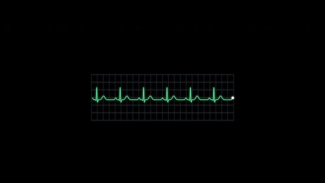 Normal Sinus Rhythm ECG Rhythm Animation Clean No Text Heart Monitor Alpha 4K