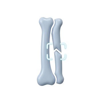 3D illustration of human forearm bones radius and ulna with digital fracture marking isolated on white background