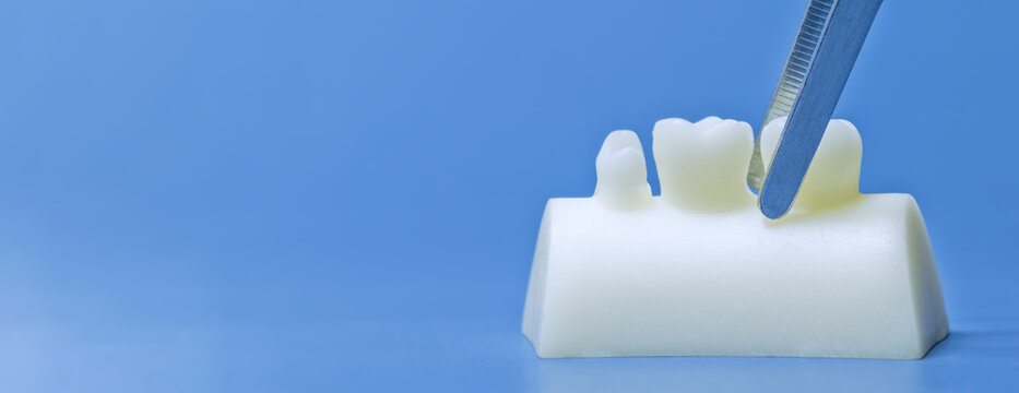 Dental extraction and prosthodontics concept. White tooth model and medical forceps on a clean blue background, panoramic layout.