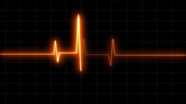 Heartbeat Monitor Animated Video, Heartbeat Medical Cardiogram Animation