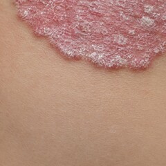 Fototapeta premium Close-up view of delicate lace fabric with detailed texture on smooth skin background in soft pink tone