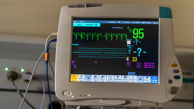 Vital sign ekg monitor in Hospital Room; Vital Signs Monitor.