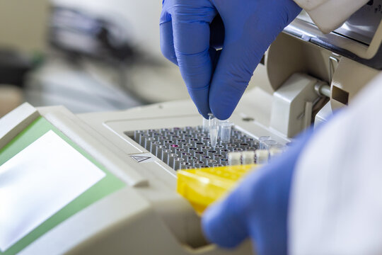 Close-up of a scientist holding a small Eppendorf tube containing a DNA sample in his fingers and placing it into a laboratory analyzer.