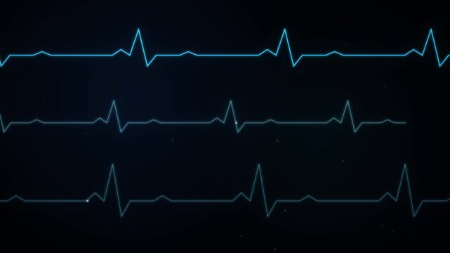 Modern digital medical heartbeat pulse monitoring with three glowing blue ecg waves moving across dark screen