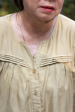 senior asian woman sweating heavily from hot summer weather in a park during daytime, elderly heat exhaustion sweating neck closeup shot