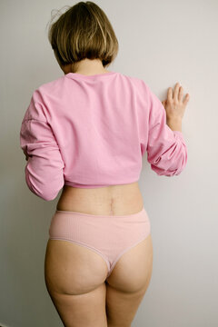 Young Woman Showing Surgical Scar on Lower Back