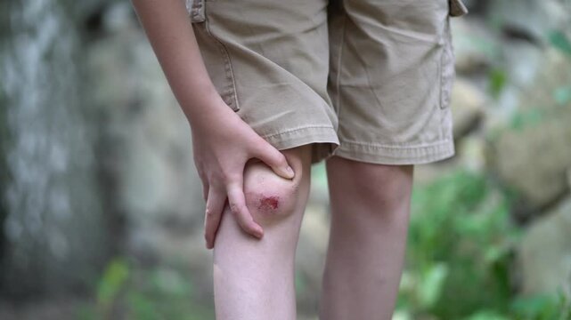 Child's knee with visible sore and wound. Hand holds the leg and inspects the red injured mark, focusing on the raw and tender skin damage.