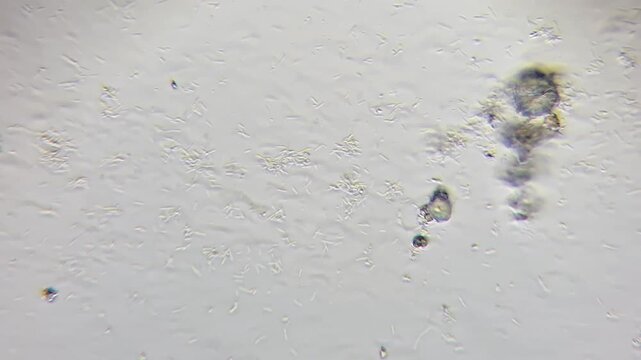 Bacillus cereus bacteria under phase contrast microscope
