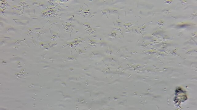 Bacillus cereus bacteria under phase contrast microscope