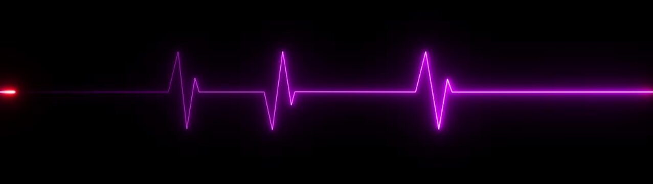 A vivid purple neon electrocardiogram line with a single bright red glowing point on one of the peaks, set against a black background, representing a critical moment or anomaly in a heart rhythm