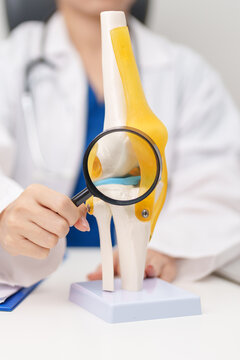 Doctor with Human Knee joint anatomy model. Osteoarthritis, Patellofemoral Pain Syndrome, Patellar Tendinitis, ACL, Anterior Cruciate Ligament, PCL, Posterior, MCL, Medial Collateral, LCL and Lateral