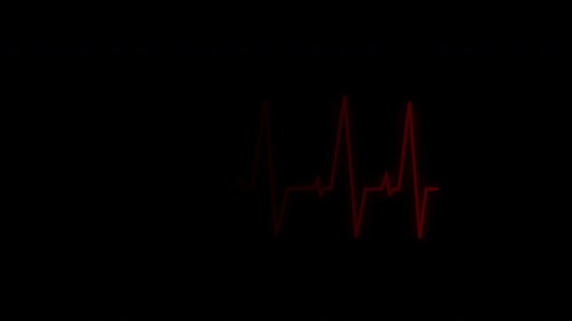 Electrocardiogram heartbeat flatline animation with glowing ECG waveform 4K resolution on black background.