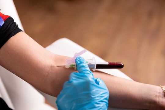 Close-up of a doctor or phlebotomist taking a blood sample into a vacuum tube from a patient's arm vein during venipuncture.