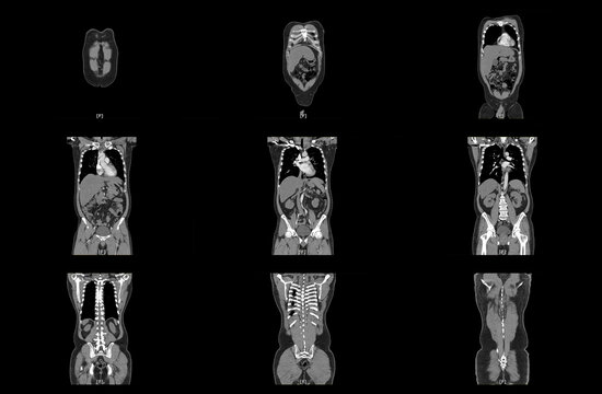 x-ray images of front body by mri ct scan Internal Organs and Liver,Lungs,Intestines,Stomach,Bladder,Kidneys.