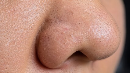 Fototapeta premium Close-up of human nose with visible skin pores and natural texture on healthy skin surface