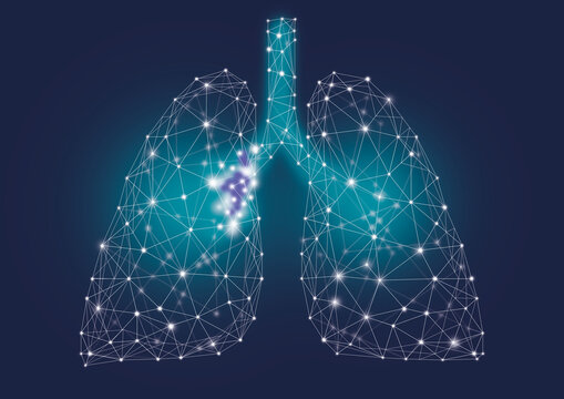 Lung cancer, conceptual illustration