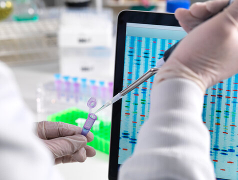Scientist pipetting a DNA sample with the results on a computer sceeen in a laboratory