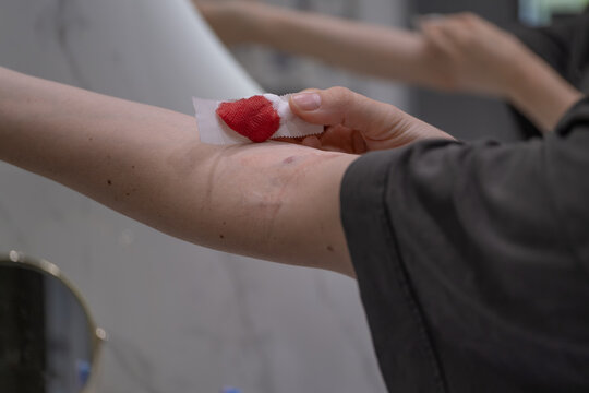 Woman Removing a Gauze Pad After a Blood Draw from a Vein at Home Close Up