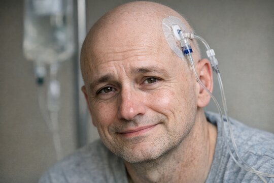 A person with electrodes on their head, possibly for medical or scientific purposes