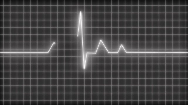 Glowing ecg heartbeat on grid background animation