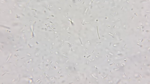 Microscopic view of Bacillus cereus bacteria at 1000x magnification, moving bacilli cells.