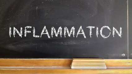 education concept on blackboard with chalk © es