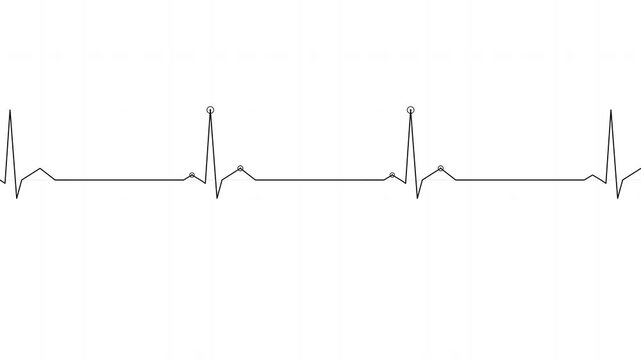 Medical Motion: Heartbeat ECG Waveform Animation for Cardiology and Healthcare Analysis.
