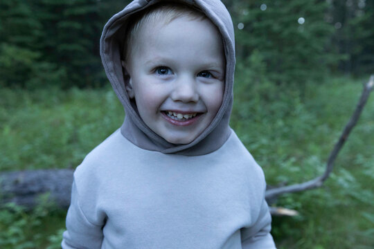Close-Up Portrait of a Smiling Boy with a Mosquito Bite and Swelling Near His Eye