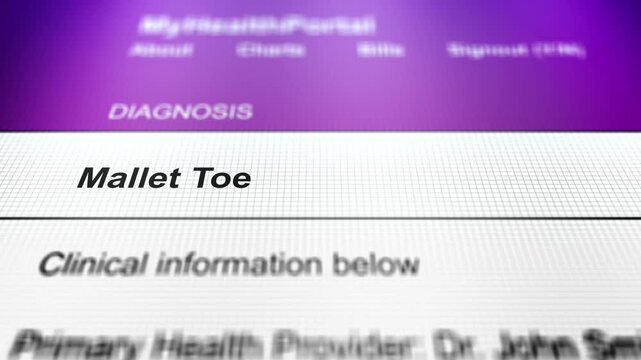 Generic Health Portal with Foot Health Problem Diagnosis - Mallet Toe