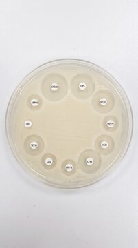 Antibiotic Resistance Petri Dish Inhibition Zone Kirby-Bauer Test Microbiology Science