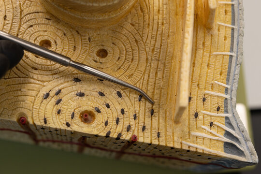 Pointer Showing Circumferential Lamellae On Compact Bone Model