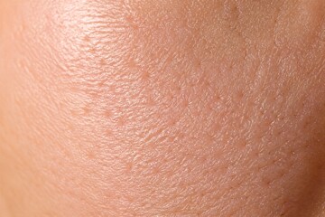 Fototapeta premium Closeup human skin texture showing pores and fine detail