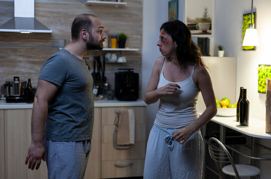 Abusive husband shouts at a terrified wife with bruises during a marriage argument, showing domestic violence, trauma and aggressive relationship conflict.
