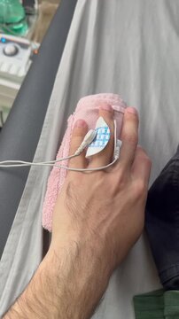 Vertical close-up of a person's finger connected to an electrical stimulation device during hand rehabilitation therapy, showing adhesive electrode and sensor attachment, static shot