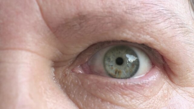 50 year old female with eye irritation, speck, Mature woman with tired eyes, optical discomfort, blurry vision problems, tired look, poor eyesight, aging, health care, close up view