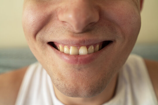 Young man smiling brightly, showcasing his teeth and happiness in a casual setting.