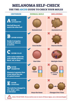 Melanoma self-check diagram comparing normal vs risky moles using the ABCDE rule focus on asymmetry, border, color, pencil eraser shows 6mm. Outline diagram