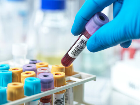 Hand of pathologist holding sample in test tube at laboratory
