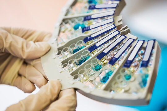 Analysing of blood sample, antibody test