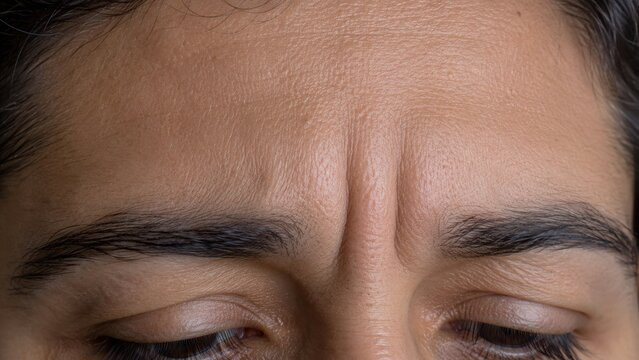 Close-up of person forehead with visible wrinkles and frown lines showing natural expression