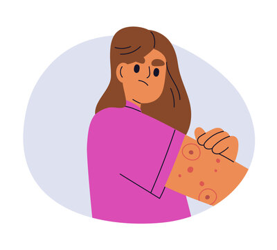 Rash, red marks on arm. Skin irritation, allergy, insect bite, dermatology problem. Inflammation, redness, itch. Woman scratching itchy hand. Flat vector illustration isolated on white background