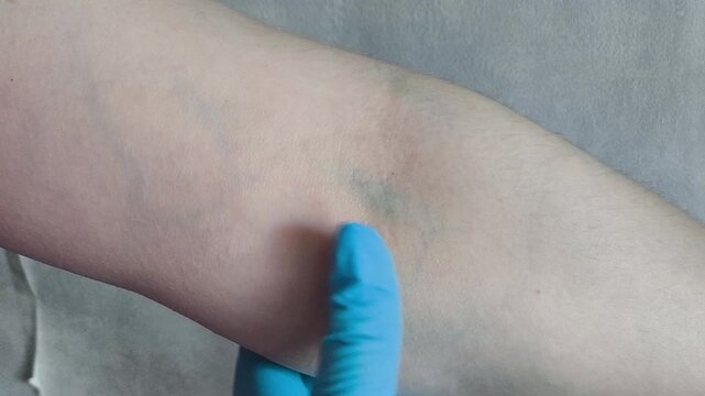 Healthcare worker palpating vein on patient's arm before intravenous injection, IV therapy, venipuncture and medical procedure concept.