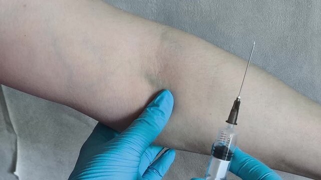 Close up of medical professional locating vein before intravenous injection, patient preparation and healthcare concept.