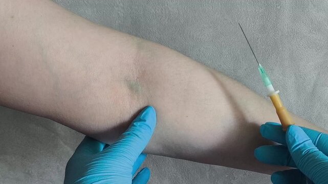 Close up of medical professional locating vein before IV catheter insertion, patient preparation and hospital treatment concept.
