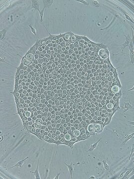 Intricate microscopic view of a cellular colony or spheroid in a culture dish, revealing complex cell growth patterns crucial for advanced biological research and medical development studies