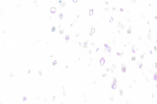 Sparkling Purple Confetti Falling Against Transparent Background