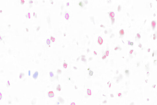 Abstract Bokeh Lights and Confetti Falling on Transparent Background